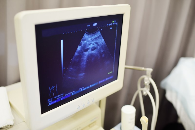 Czy badanie ultrasonograficzne jest bezpieczne w okresie ciąży?